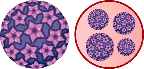 علائم ویروس HPV